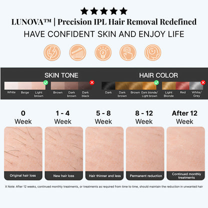 LUNOVA — Quintessential Photo-Epilation System