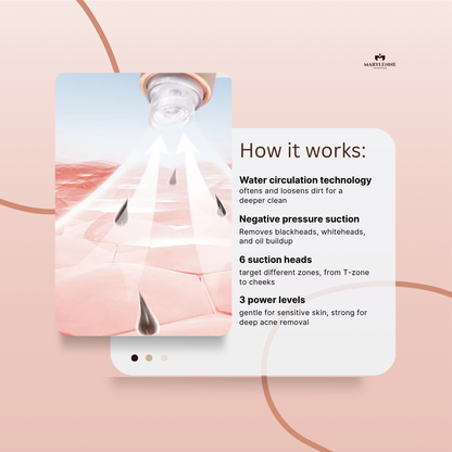 NEVORA | Pore Vacuum for Blackheads & Clear Skin