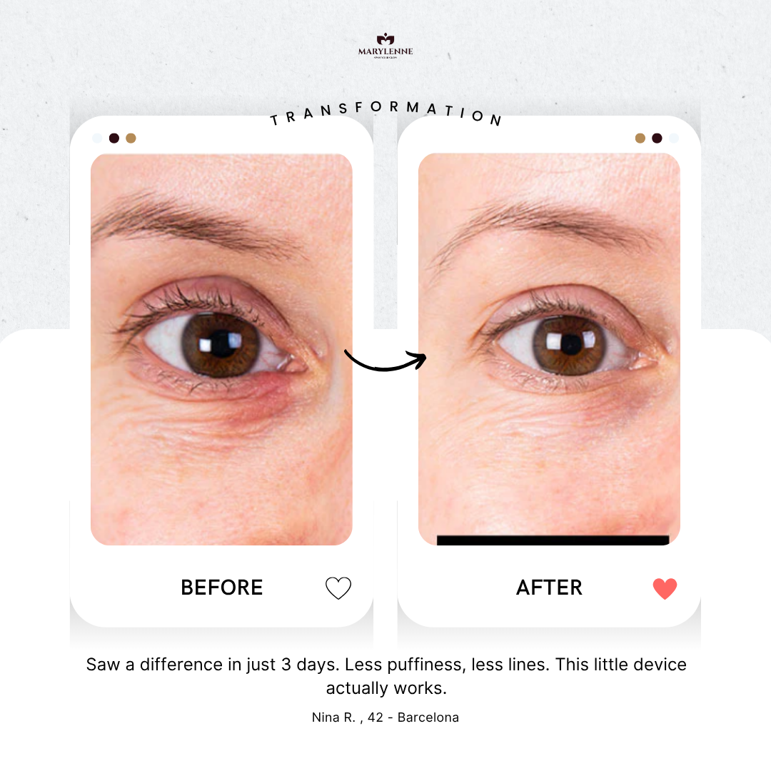 TENSORA | Red Light Eye Mask for Puffiness & Wrinkles