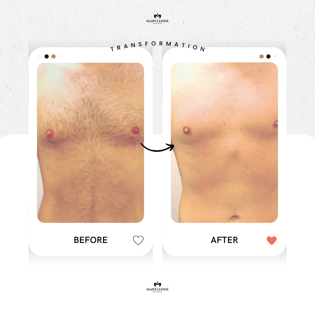 LUNOVA | Pain-Free IPL Hair Removal at Home