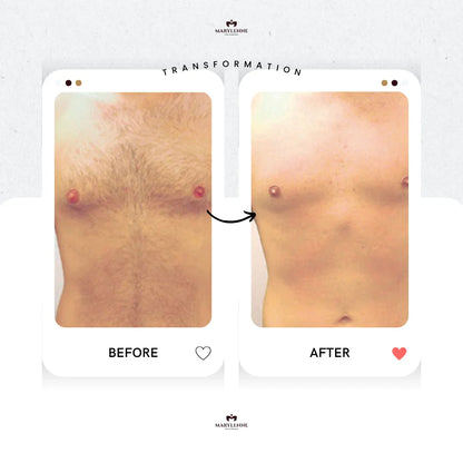 LUNOVA | Pain-Free IPL Hair Removal at Home