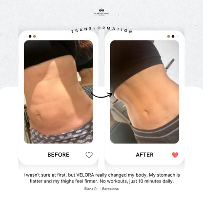 VELORA | Body Sculptor for Cellulite, Firmness & Glow